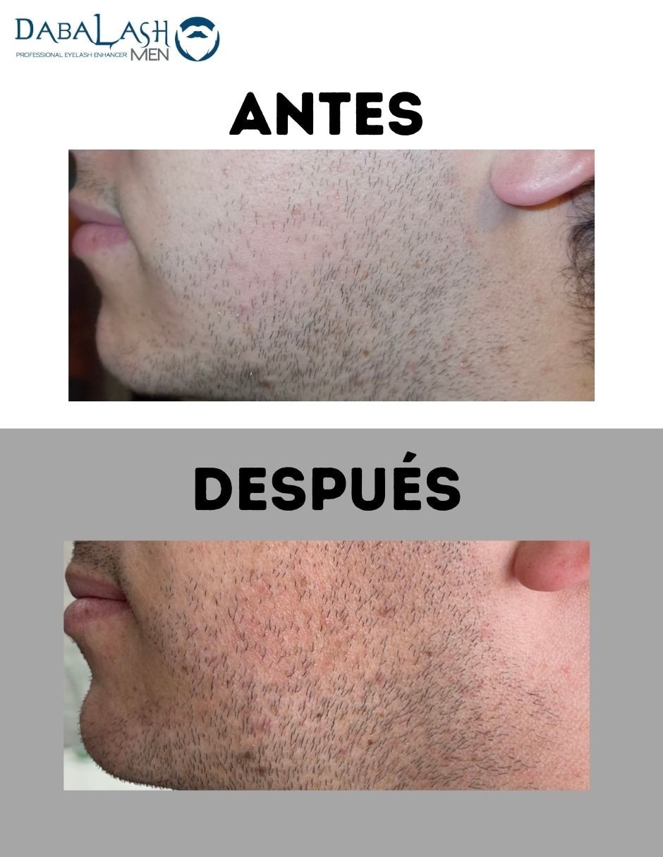 Tratamiento para (si aplica) Barba Suero para Crecimiento de Barba y Bigote Men Fortalecedor DABALASH DABALASH MEN 3